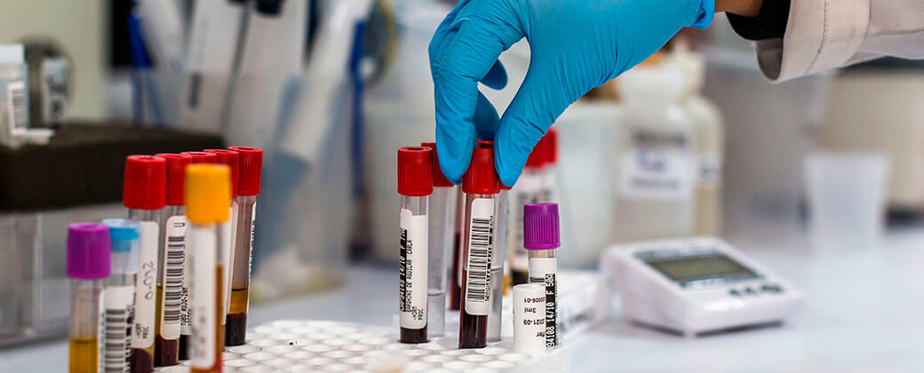 Laboratorio de Análisis Clínico